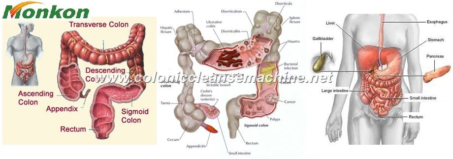 How to Cleanse the Small Intestine Naturally?