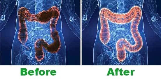 How to Clean Your Stomach Out?