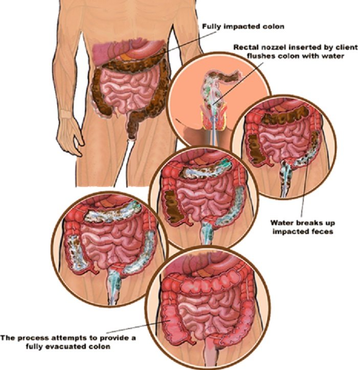 How Do I Clean My Stomach?