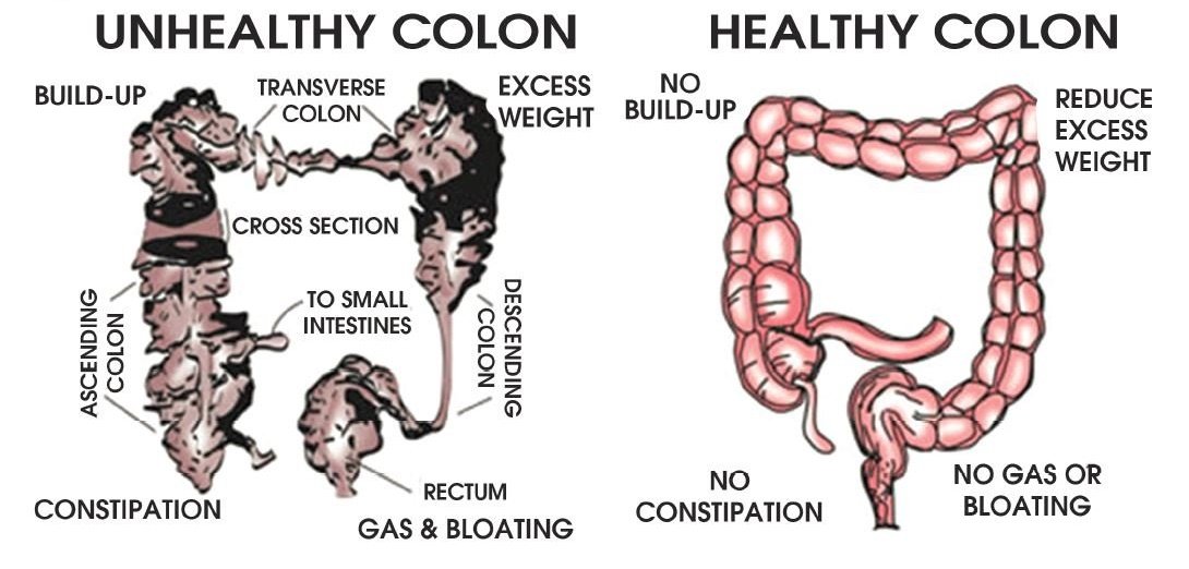 Medical Colon Cleanse Machine 151